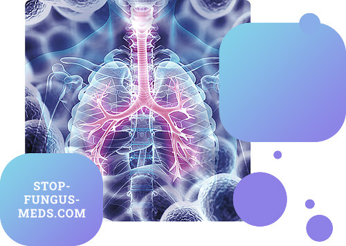 Fungal diseases of the respiratory system